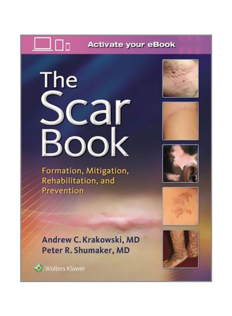 The Scar Book: Formation, Mitigation, Rehabilitation And Prevention Hardcover