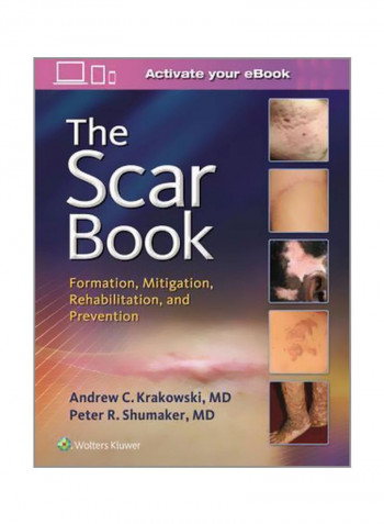 The Scar Book: Formation, Mitigation, Rehabilitation And Prevention Hardcover