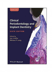 Clinical Periodontology And Implant Dentistry, 2 Volume Set Hardcover 6