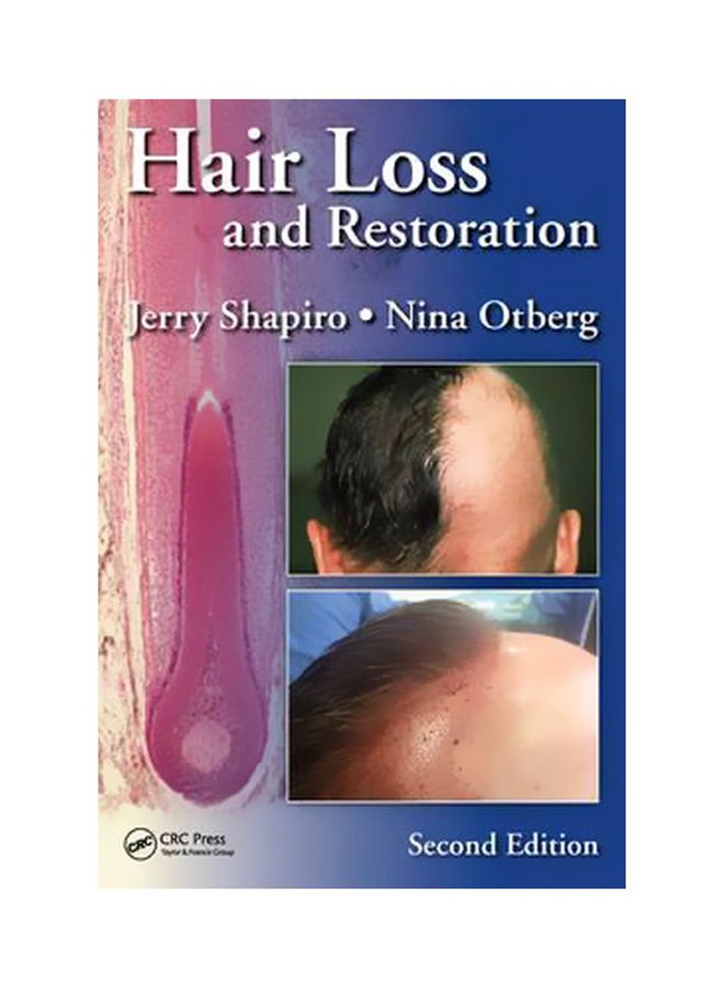 Hair Loss And Restoration Hardcover 2