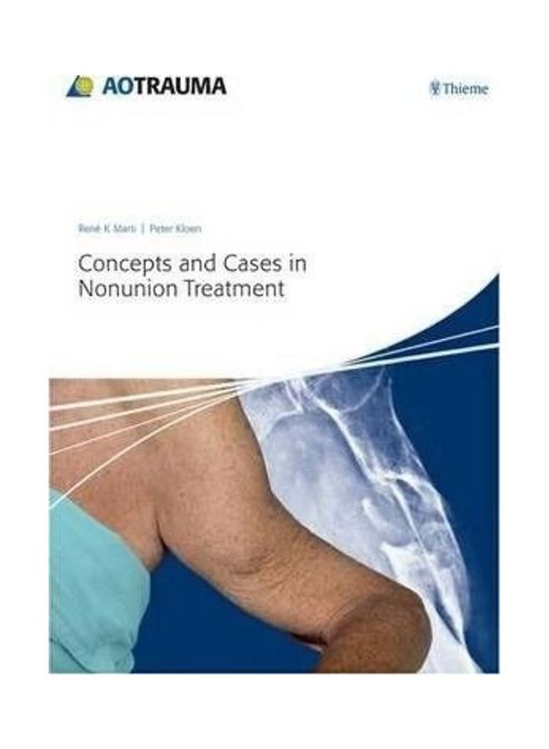 Concepts And Cases In Nonunion Treatment Hardcover English by Rene K. Marti