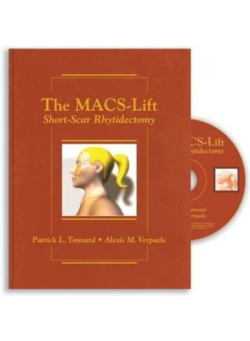 The Macs-Lift Short Scar Rhytidectomy Hardcover English by Patrick L Tonnard