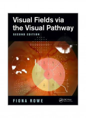 Visual Fields Via The Visual Pathway Paperback 2