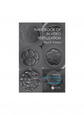 Handbook Of In Vitro Fertilization Paperback 4