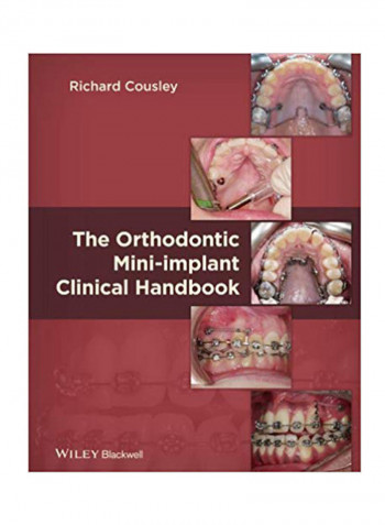 The Orthodontic Mini-implant Clinical Handbook Hardcover