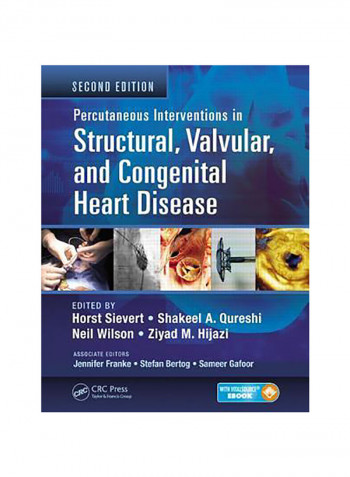 Structural, Valvular And Congenital Heart Disease Hardcover