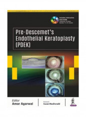 Pre-Descemet's Endothelial Keratoplasty (PDEK) Hardcover 1