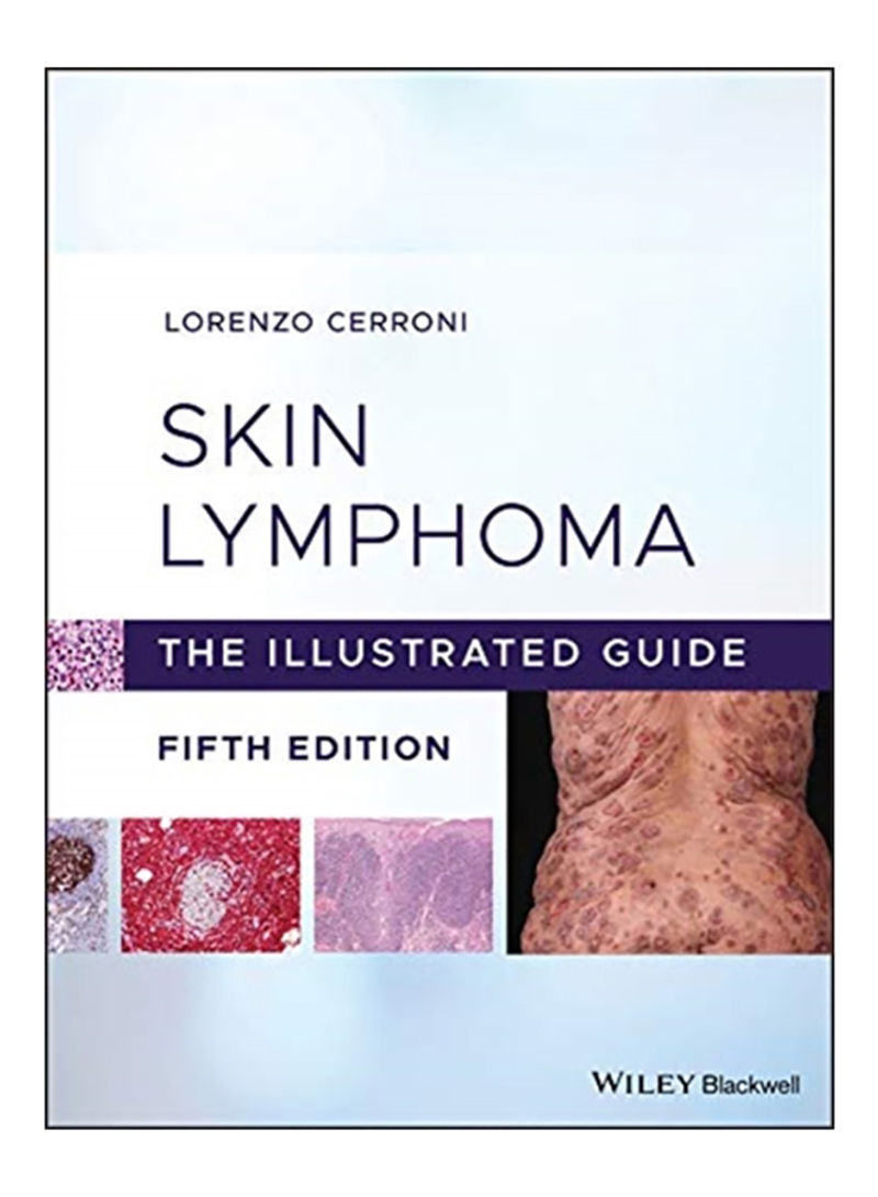 Skin Lymphoma: The Illustrated Guide Hardcover 5