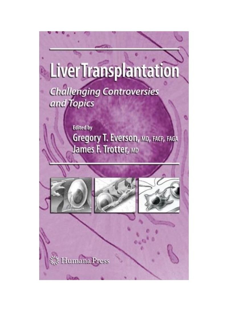 Liver Transplantation Paperback English by Gregory T. Everson