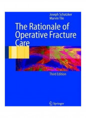 The Rationale Of Operative Fracture Care Hardcover English by Joseph Schatzker