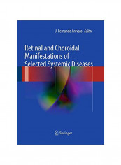 Retinal And Choroidal Manifestations Of Selected Systemic Diseases Paperback