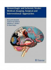 Hemorrhagic And Ischemic Stroke Hardcover English by Bernard R. Bendok