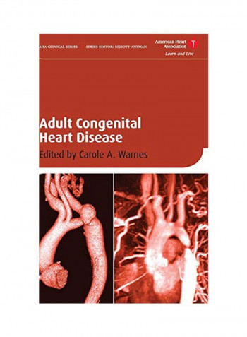 Adult Congenital Heart Disease Hardcover