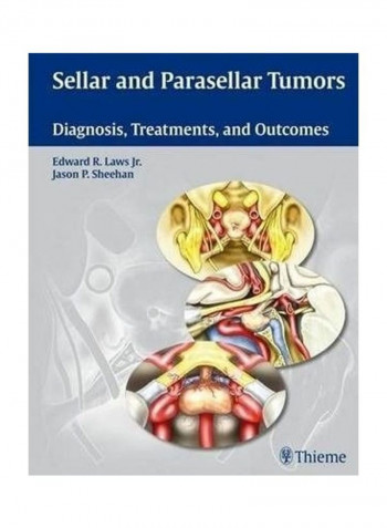 Sellar And Parasellar Tumors Hardcover English by Edward R. Laws, Jr.