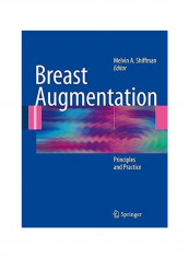 Breast Augmentation: Principles And Practice Hardcover