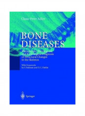 Bone Diseases: Macroscopic, Histological, and Radiological Diagnosis of Structural Changes in the Skeleton Hardcover English by F. Steel