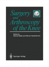 Surgery And Arthroscopy Of The Knee Paperback reviews Surgery And Arthroscopy Of The Knee Paperback