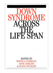Down Syndrome Across The Life Span Paperback reviews Down Syndrome Across The Life Span Paperback