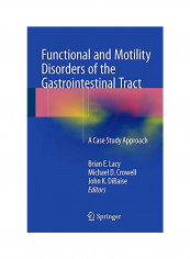 Functional And Motility Disorders Of The Gastrointestinal Tract Paperback English by Brian E. Lacy reviews Functional And Motility Disorders Of The Gastrointestinal Tract Paperback English by Brian E. Lacy