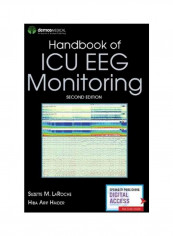 Handbook Of ICU EEG Monitoring Paperback reviews Handbook Of ICU EEG Monitoring Paperback