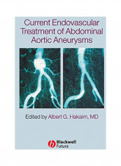 Current Endovascular Treatment Of Abdominal Aortic Aneurysms Hardcover