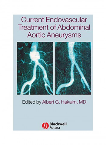Current Endovascular Treatment Of Abdominal Aortic Aneurysms Hardcover