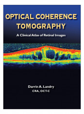 Optical Coherence Tomography Hardcover