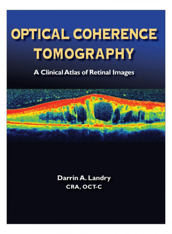 Optical Coherence Tomography Hardcover