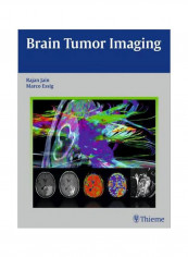 Brain Tumor Imaging Hardcover