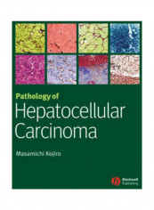Pathology of Hepatocellular Carcinoma Hardcover English by Masamichi Kojiro