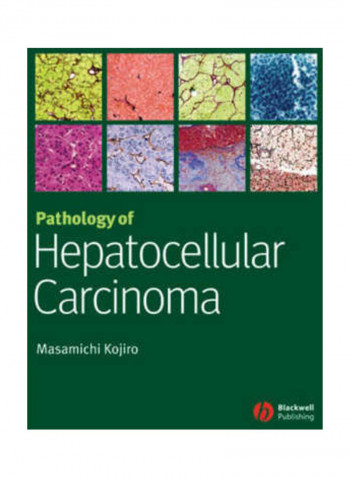 Pathology of Hepatocellular Carcinoma Hardcover English by Masamichi Kojiro