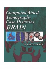 Computed Aided Tomography Case Histories: Brain Hardcover English by D Karthikeyan