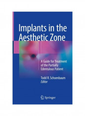 Implants In The Aesthetic Zone Hardcover reviews Implants In The Aesthetic Zone Hardcover