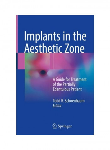 Implants In The Aesthetic Zone Hardcover
