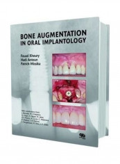 Bone Augmentation In Oral Implantology Hardcover English by Fouad Khoury