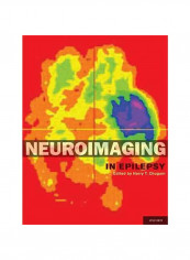 Neuroimaging In Epilepsy Hardcover reviews Neuroimaging In Epilepsy Hardcover