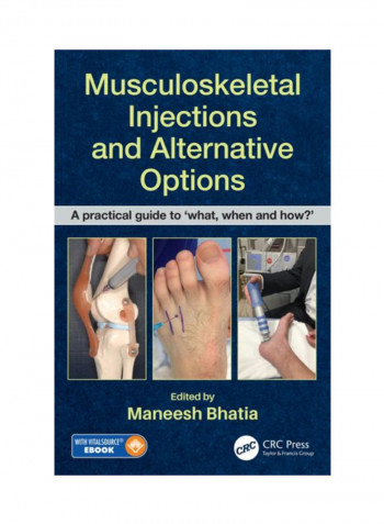 Musculoskeletal Injections And Alternative Options: A Practical Guide to 'What, When And How?' Hardcover