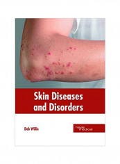Skin Diseases And Disorders Hardcover reviews Skin Diseases And Disorders Hardcover