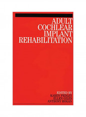 Adult Cochlear Implant Rehabilitation Paperback