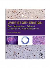 Liver Regeneration: Basic Mechanisms, Relevant Models And Clinical Applications Hardcover