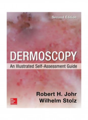 Dermoscopy: An Illustrated Self-Assessment Guide Paperback 2