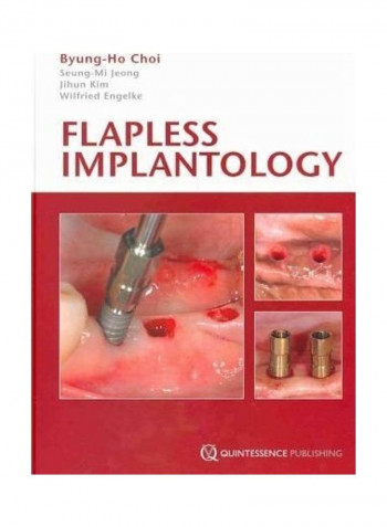 Flapless Implantology: An Atlas Of Composite Applications In Esthetic Dentistry Hardcover English by Byung-Ho Choi
