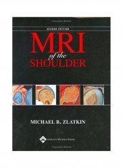 MRI Of The Shoulder Hardcover English by Michael B. Zlatkin