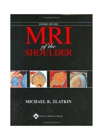 MRI Of The Shoulder Hardcover English by Michael B. Zlatkin