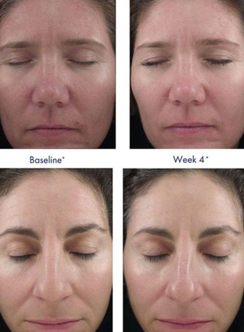Retinol 1.0 Anti Ageing Cream 28g