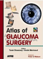 Atlas of Glaucoma Surgery Paperback English reviews Atlas of Glaucoma Surgery Paperback English