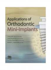 Applications Of Orthodontic Mini Implants Hardcover English by Jong Suk Lee