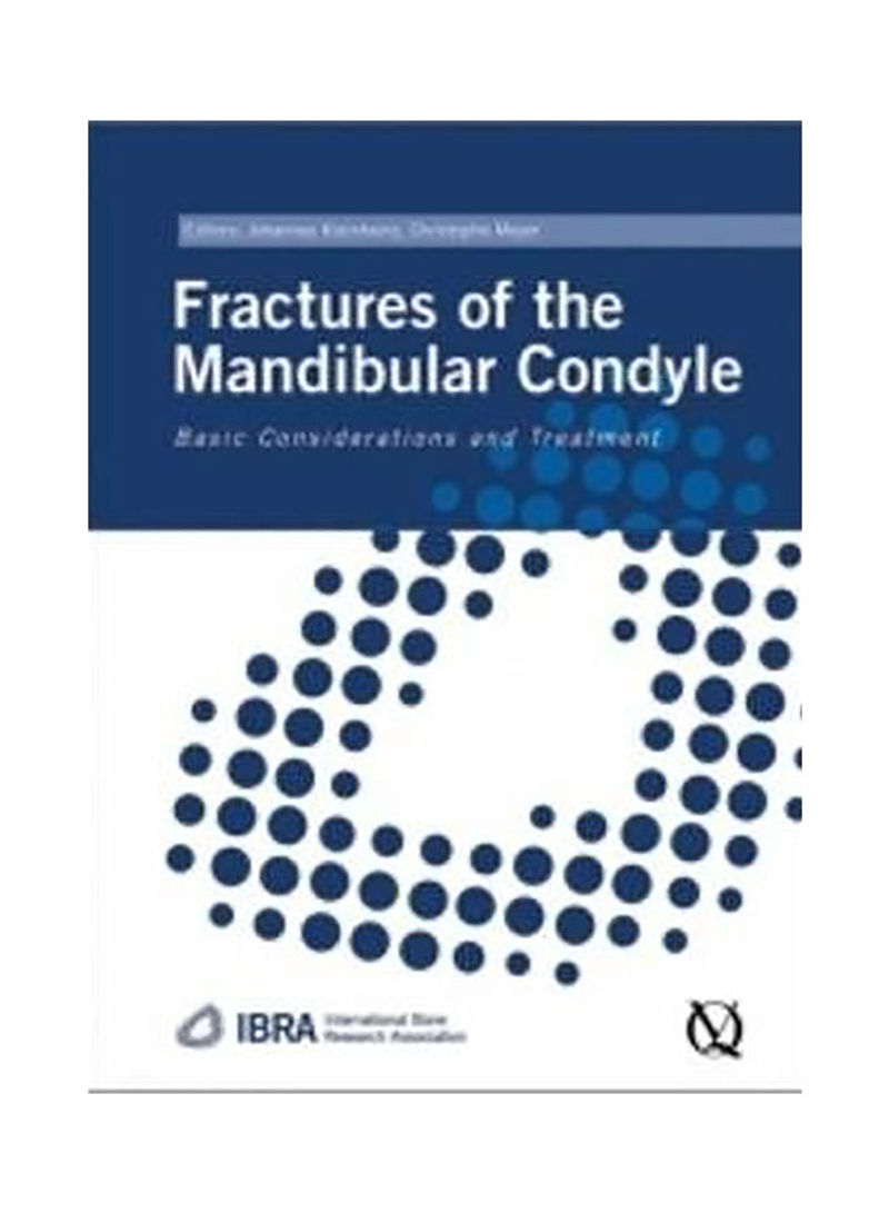 Fractures Of The Mandibular Condyle Hardcover