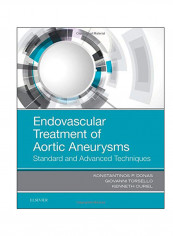 Endovascular Treatment Of Aortic Aneurysms Hardcover