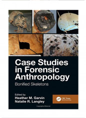 Case Studies in Forensic Anthropology: Bonified Skeletons Hardcover 1